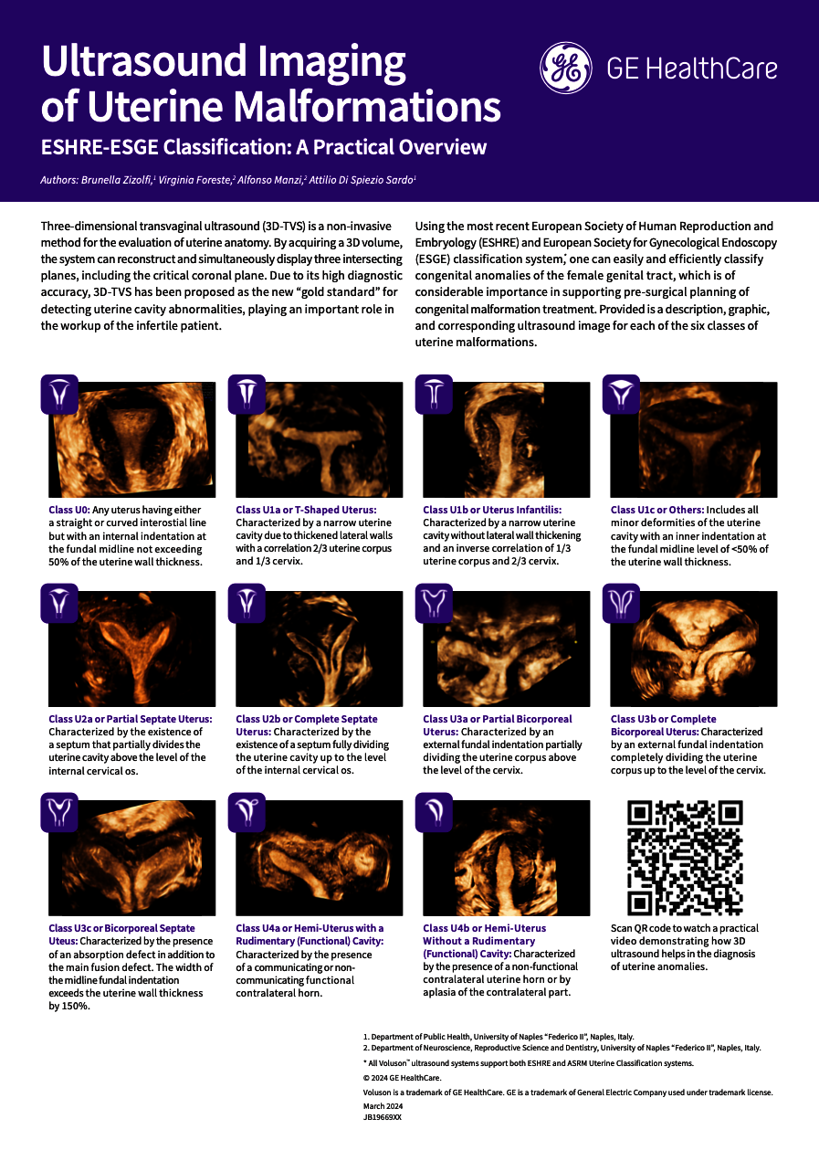  Ultrasound Imaging of Uterine Malformations