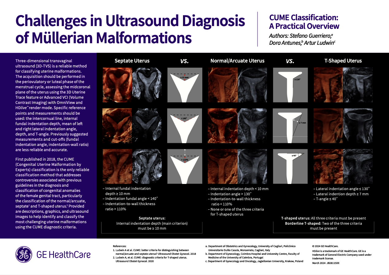  Challenges in Ultrasound Diagnosis of Müllerian Malformations