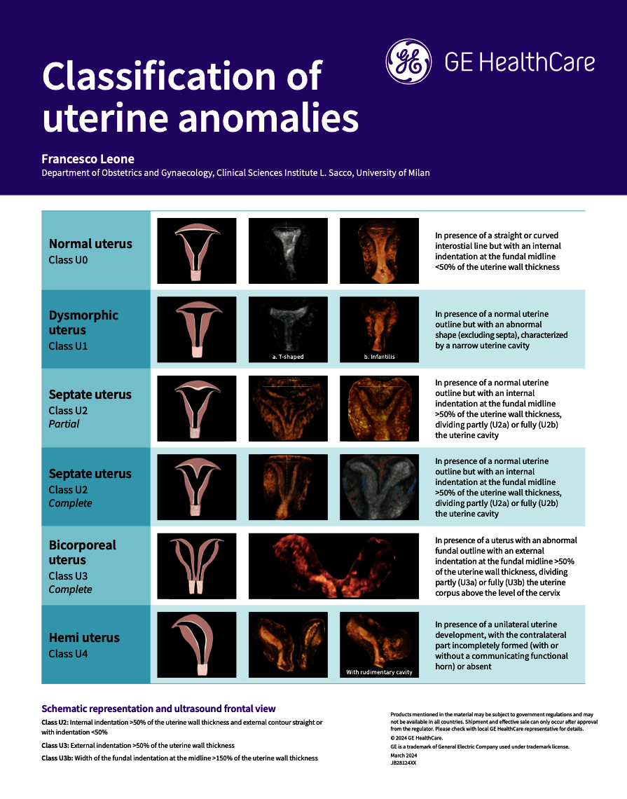  Classification of Uterine Anomalies