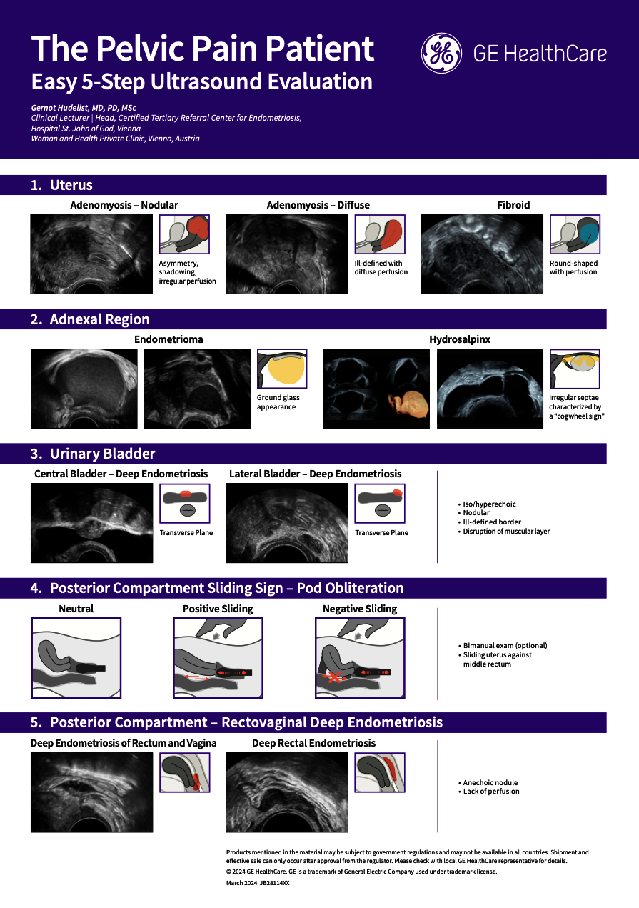  Pelvic Pain Poster