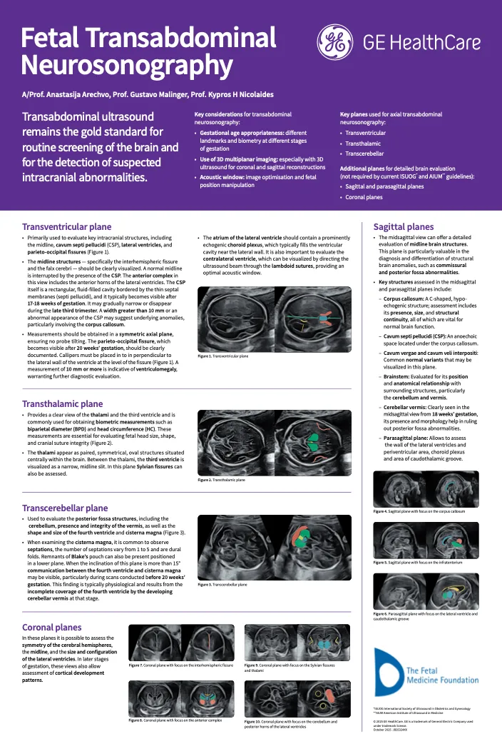  Fetal brain transabdominal neurosonography