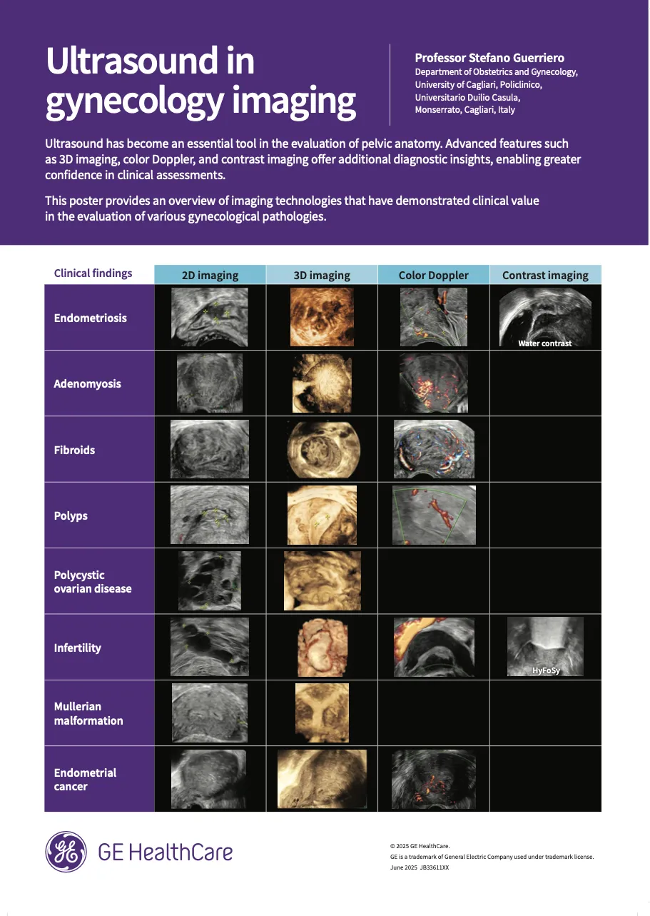 Ultrasound in gynecology imaging