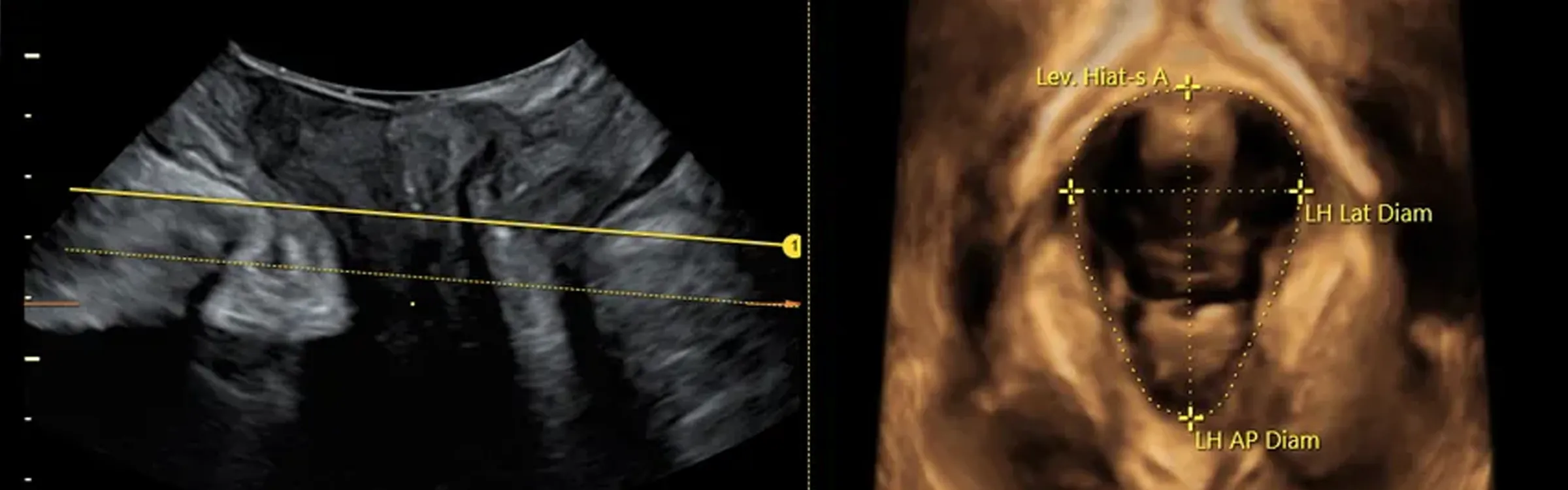 The Pelvic Floor: More than “Just a Muscle”