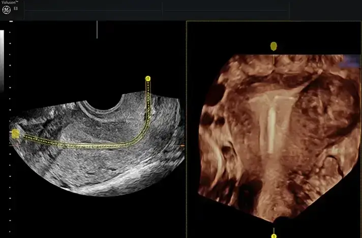 Uterine assessment images 1