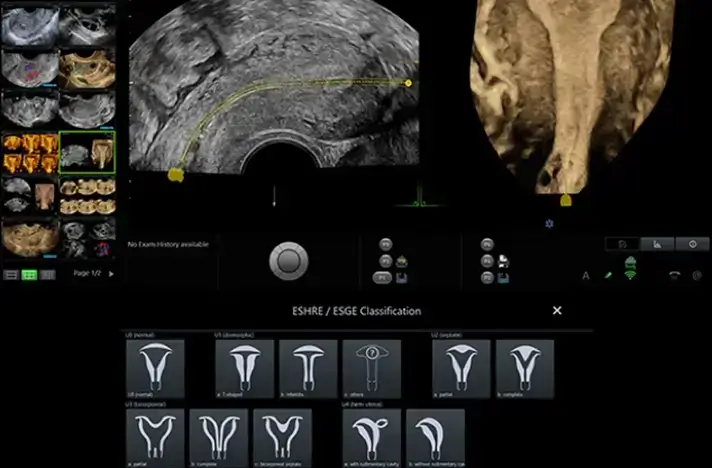 Uterine assessment images 3