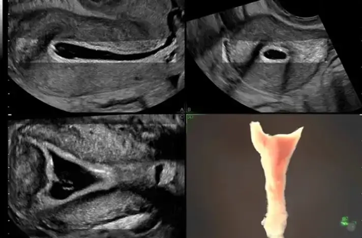 Uterine assessment images 4